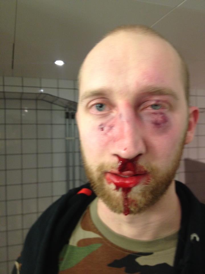 Spridning, Misshandel, Rasism,  Henrik Johansson,  Delning, Facebook, Filip Wennerlund, Biograf
