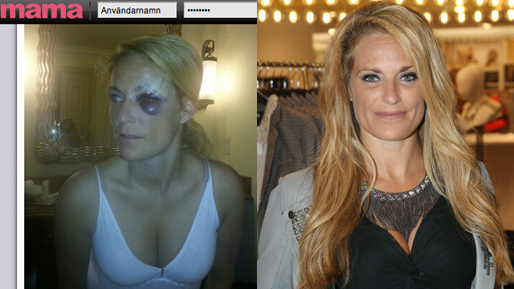 Halloween, Blåtira, sjukhus, Laila Bagge