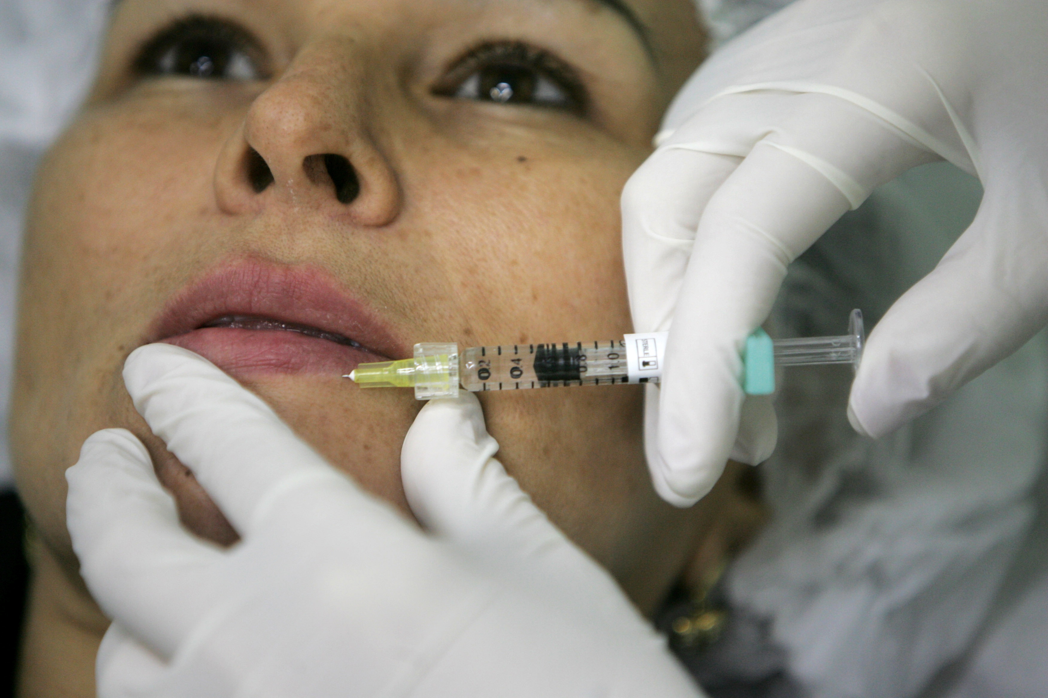 Silikon, Skönhetsideal, Plastikkirurgi, Skönhetsoperationer, PIP-implantat