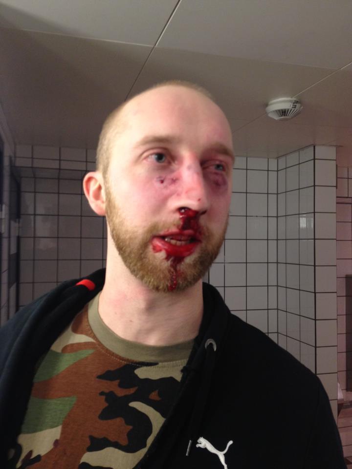 Biograf, Facebook, Rasism,  Henrik Johansson, Misshandel,  Delning, Spridning, Filip Wennerlund