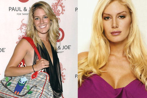 plastikoperationer, Plastikkirurgi, janice dickinson, plastikpanik, Heidi Montag, ånger, Silikon