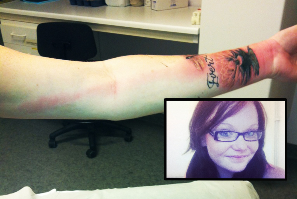 Visby, Tatuering, Gotland, Infektion