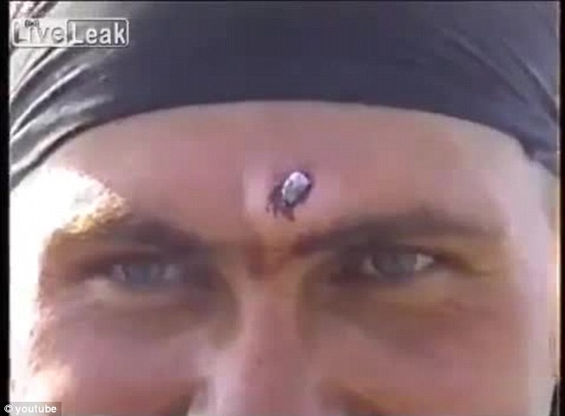 Rysk, Kula, Soldat, Militären, Skottsår, Ryssland