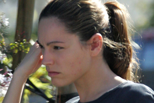 Skonhet, Dålig hy, Finnar, Kändisar