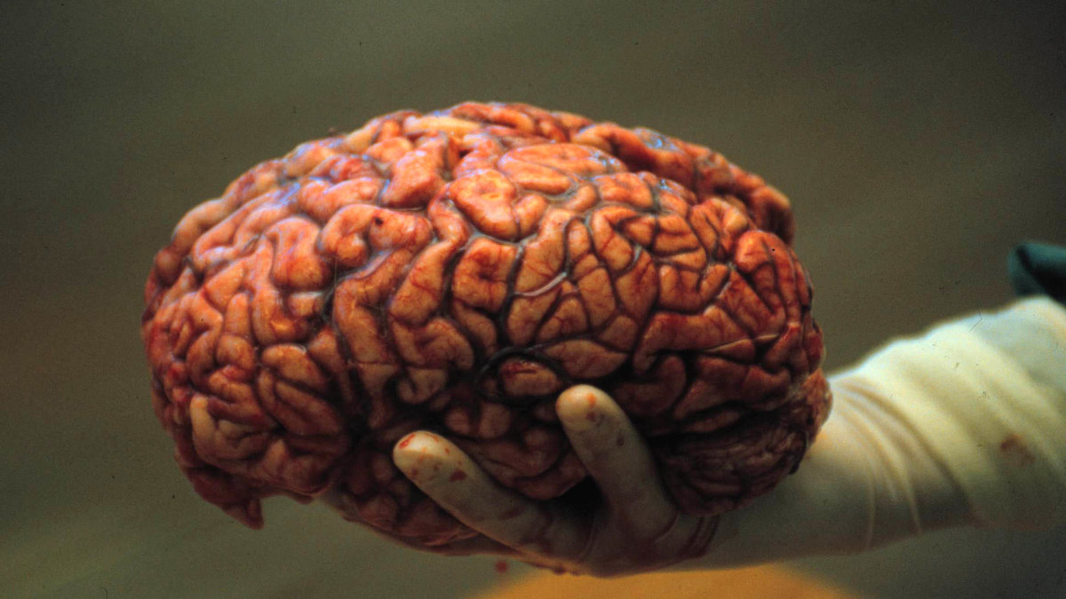 Den mänskliga hjärnan - starkare än alla superdatorer.