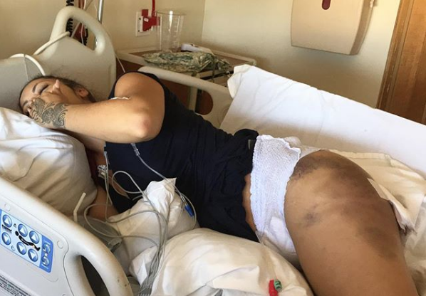 Jenelle efter operationen. Jenelle efter operationen.