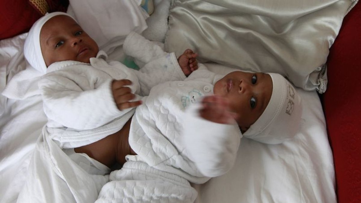 Hassan och Boubacar satt ihop när de föddes. 