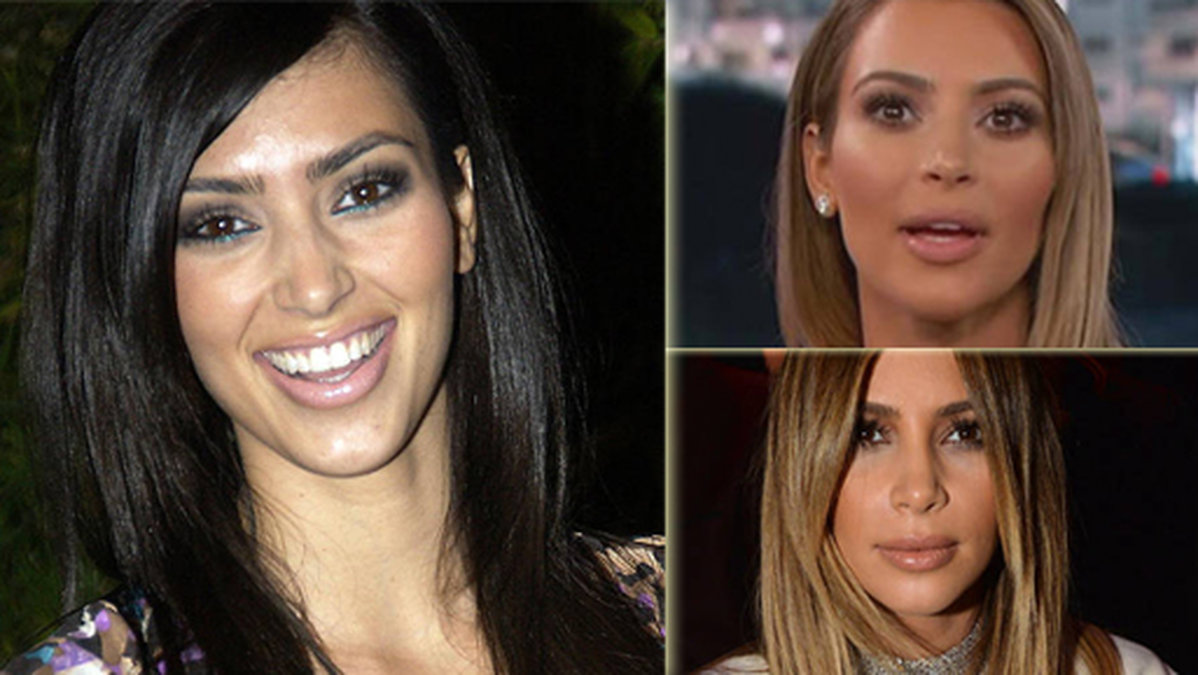 Kim Kardashian före och efter sina många ingrepp och operationer.