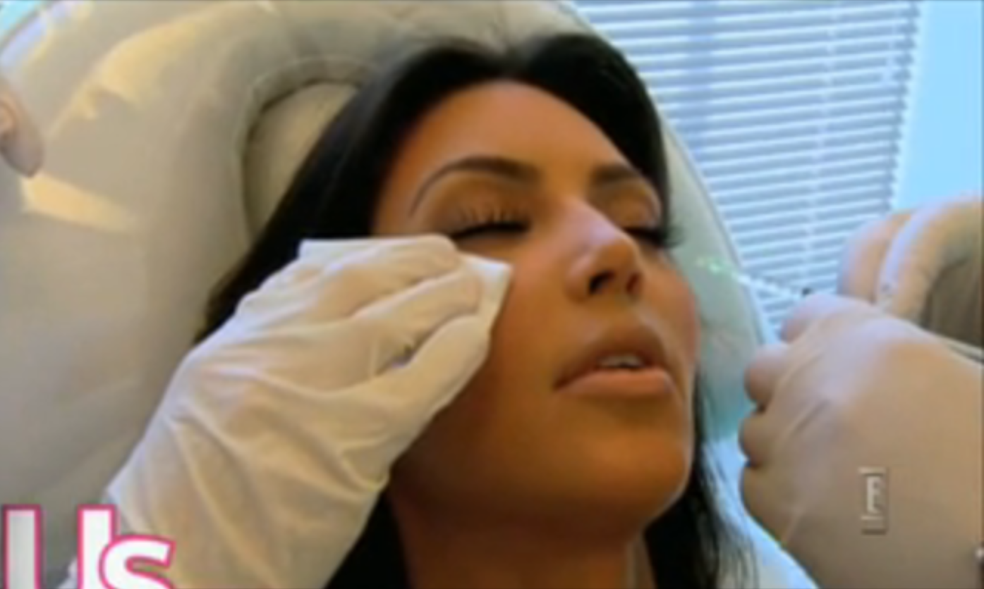 USA, Kim Kardashian, Behandling, Botox