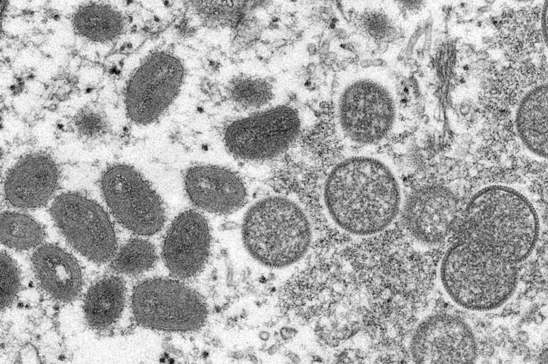 Apkoppsviruset är ett dna-virus, som muterar betydligt långsammare än rna-virus. Arkivbild.