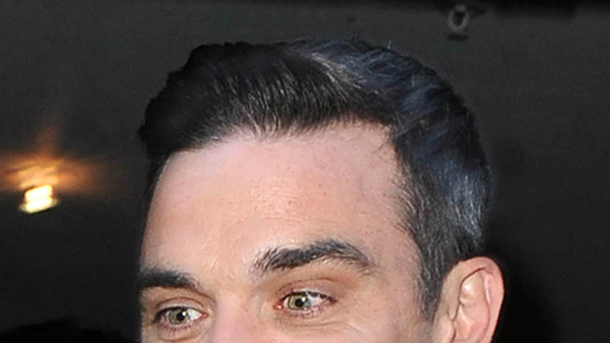 Robbie Williams har berättat att han gjorde en hårtransplantion eftersom livet i Los Angeles påverkade honom. Så här såg han ut 2010.