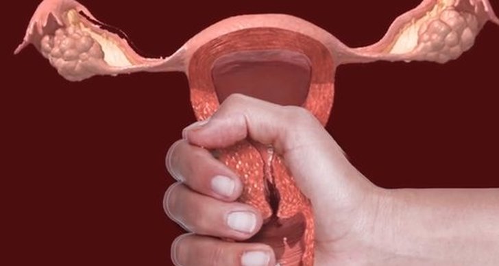 menstruation, Mensvärk, Choklad, Sex- och samlevnad