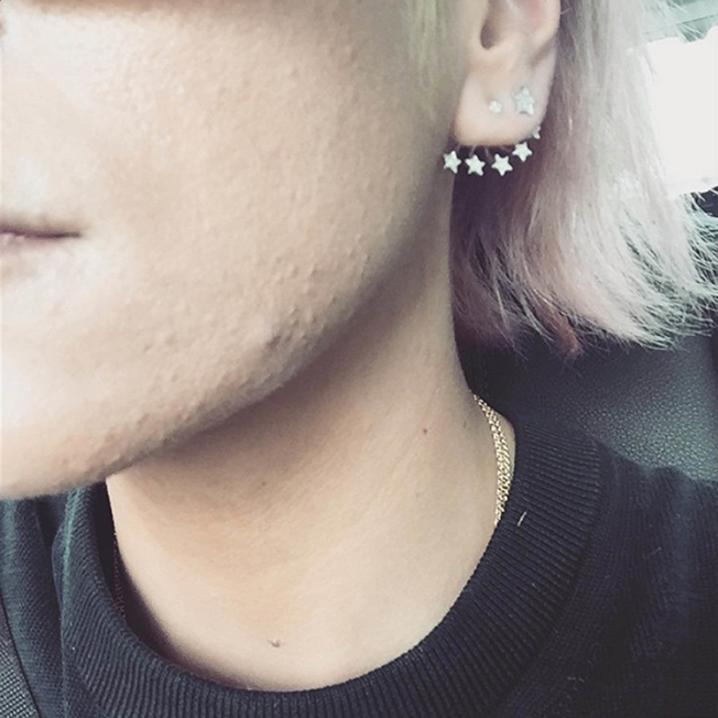 Lily Allen Lily Allen