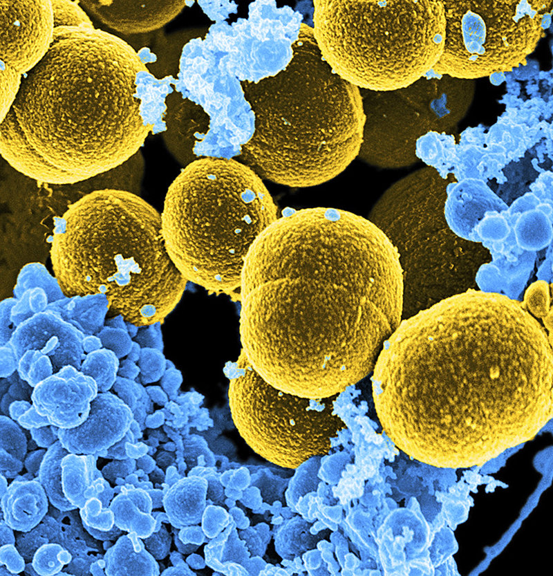 Bakterier kommunicerar med varandra kemiskt. På bilden, i gult, syns en av de vanligast förekommande arterna, Staphylococcus aureus. Den orsakar ibland svår matförgiftning.