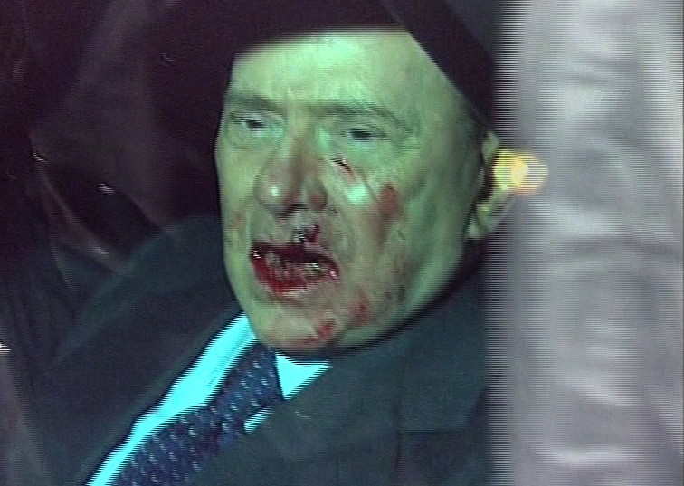 En chockad och skadad Silvio Berlusconi på väg till sjukhus.