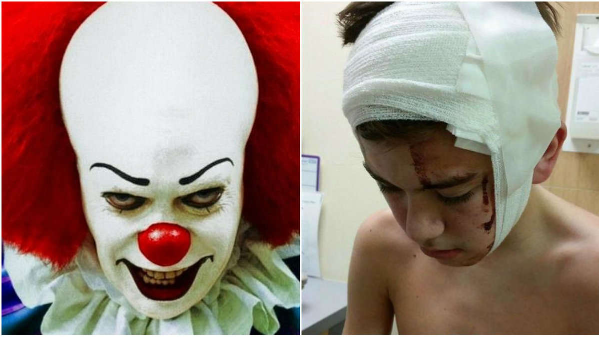 En 17-årig kille blev skadad efter att en clown kastade en pinne. 
