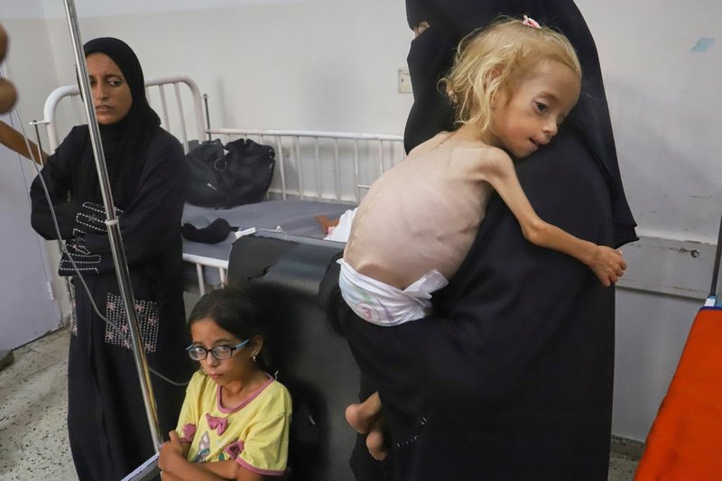 Islam Qudeih och dottern Shamm på Nassersjukhuset i Khan Younis i södra Gaza den 9 augusti. Fotografen som tog bilden för AP dödades i Israels attack mot sjukhuset den 25 augusti.