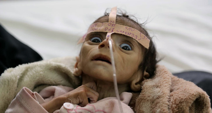 Pojke, Jemen, Svält