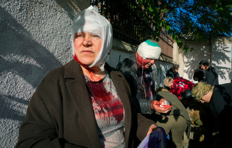 Människor får vård på en gata i Kiev efter morgonens attacker.