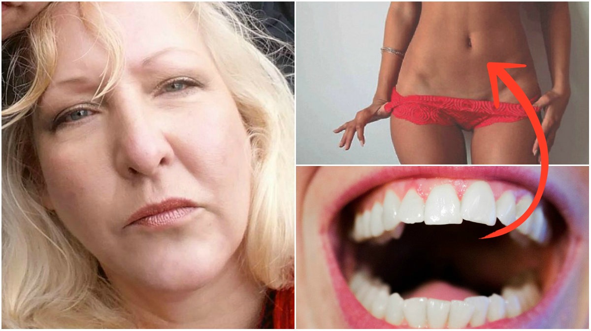 Theresas vagina fick "tänder". 