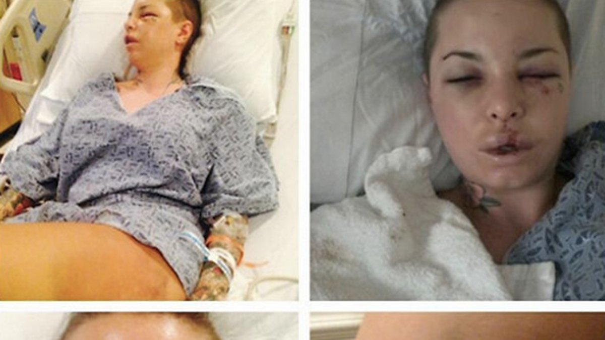 De här bilderna la Christy Mack själv ut på sin Twitter efter misshandeln. 
