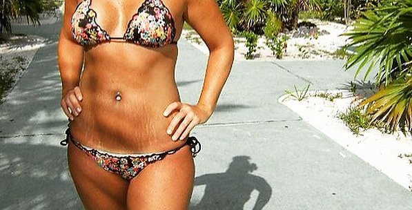 Kvinna i mönstrad bikini på gatan Posering med härlig mage