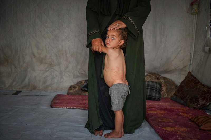 Mohammad Abu Hilal, två år gammal, med sin mamma Yasmine i familjens tält i al-Mawasi i södra Gazaremsan tidigare i maj.