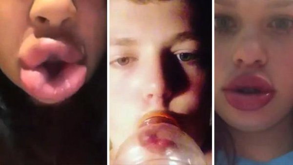 Kylie Jenner lip challenge Kylie Jenner lip challenge