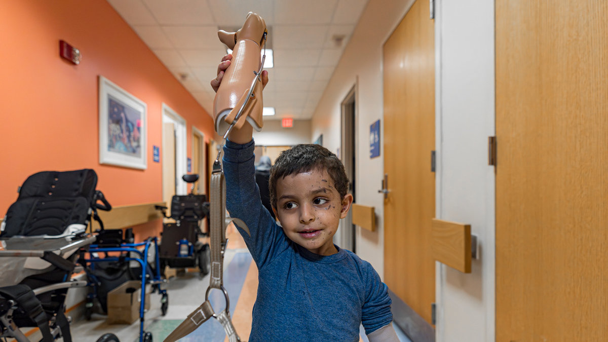 Omar Abu Kuwaik, 4, visar upp sin nya armprotes på ett barnsjukhus i Philadelphia, USA. Bilden är tagen den 28 februari.