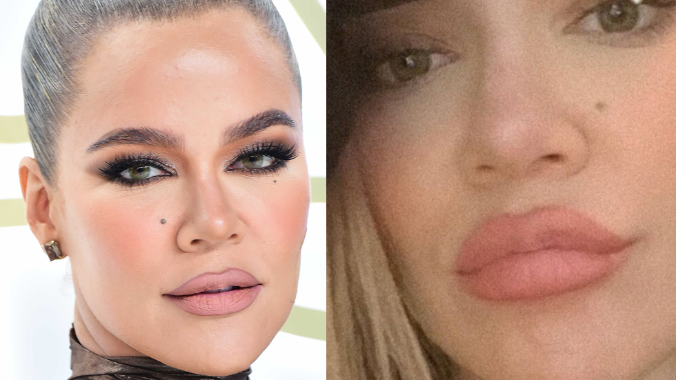 Khloé Kardashian uppmanas att söka hjälp efter nya bilderna "Inte normalt"