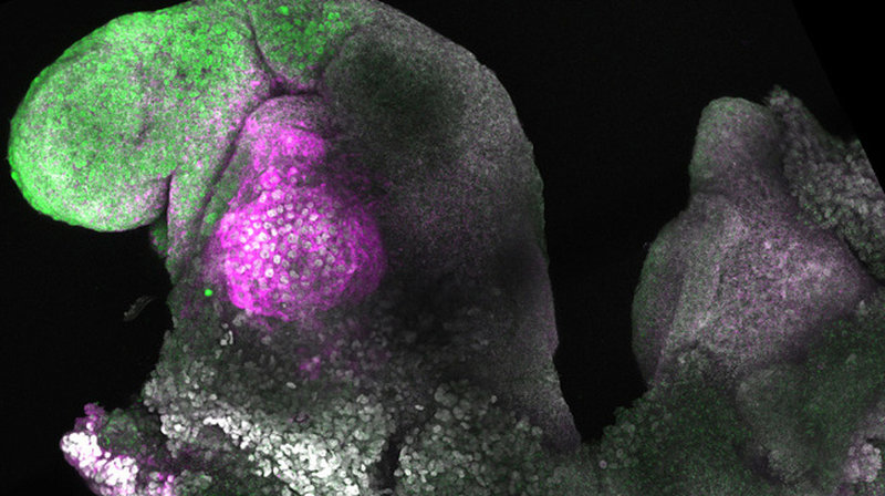 Mikroskopbild av ett syntetiskt musembryo. Det gröna visar hjärnstruktur och det lila är hjärtvävnad.