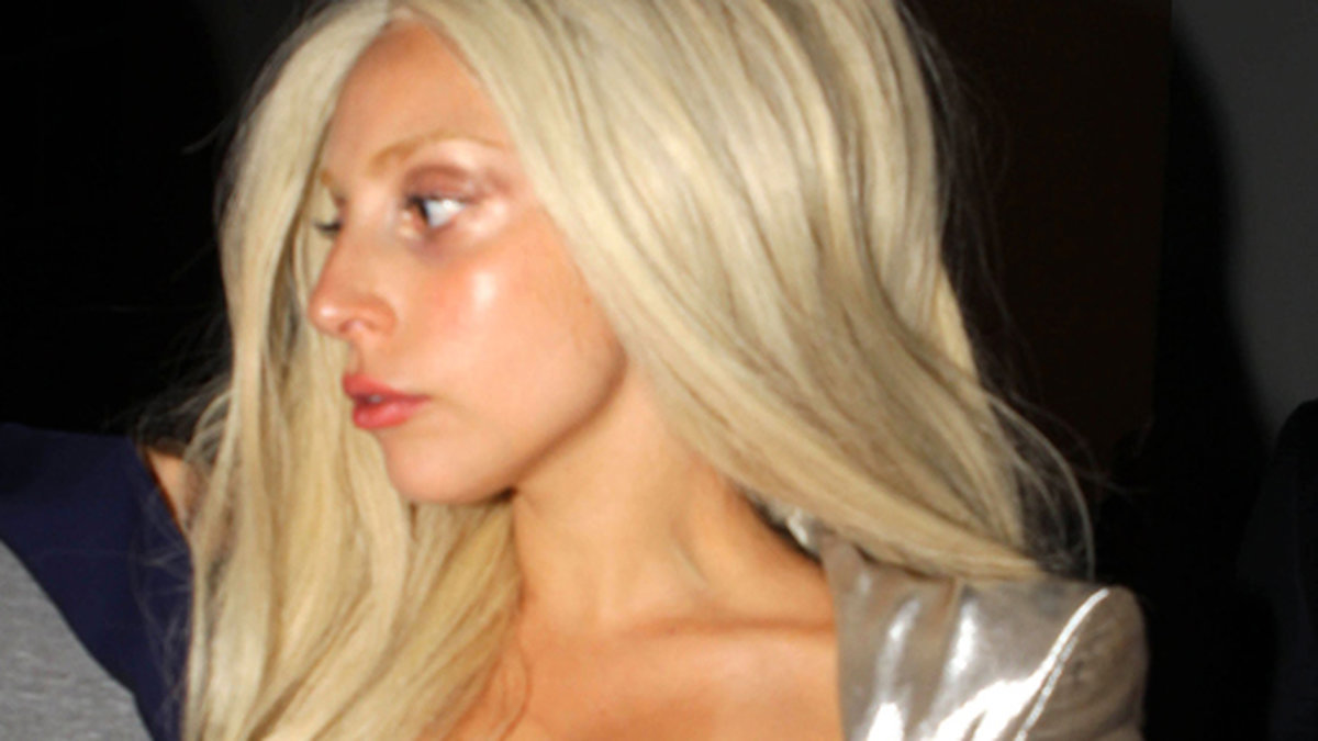 Lady Gaga har varit borta från rampljuset ett par månader. Detta efter en höftoperation. 