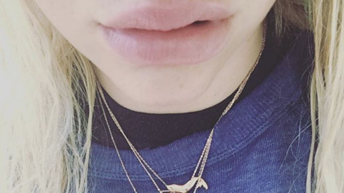 Kesha har betydligt större läppar idag. 