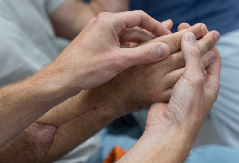 Patienten fick nya händer i en dubbel handtransplantation. Pressbild. Foto: Claes Fröhling Patienten fick nya händer i en dubbel handtransplantation. Pressbild. Foto: Claes Fröhling