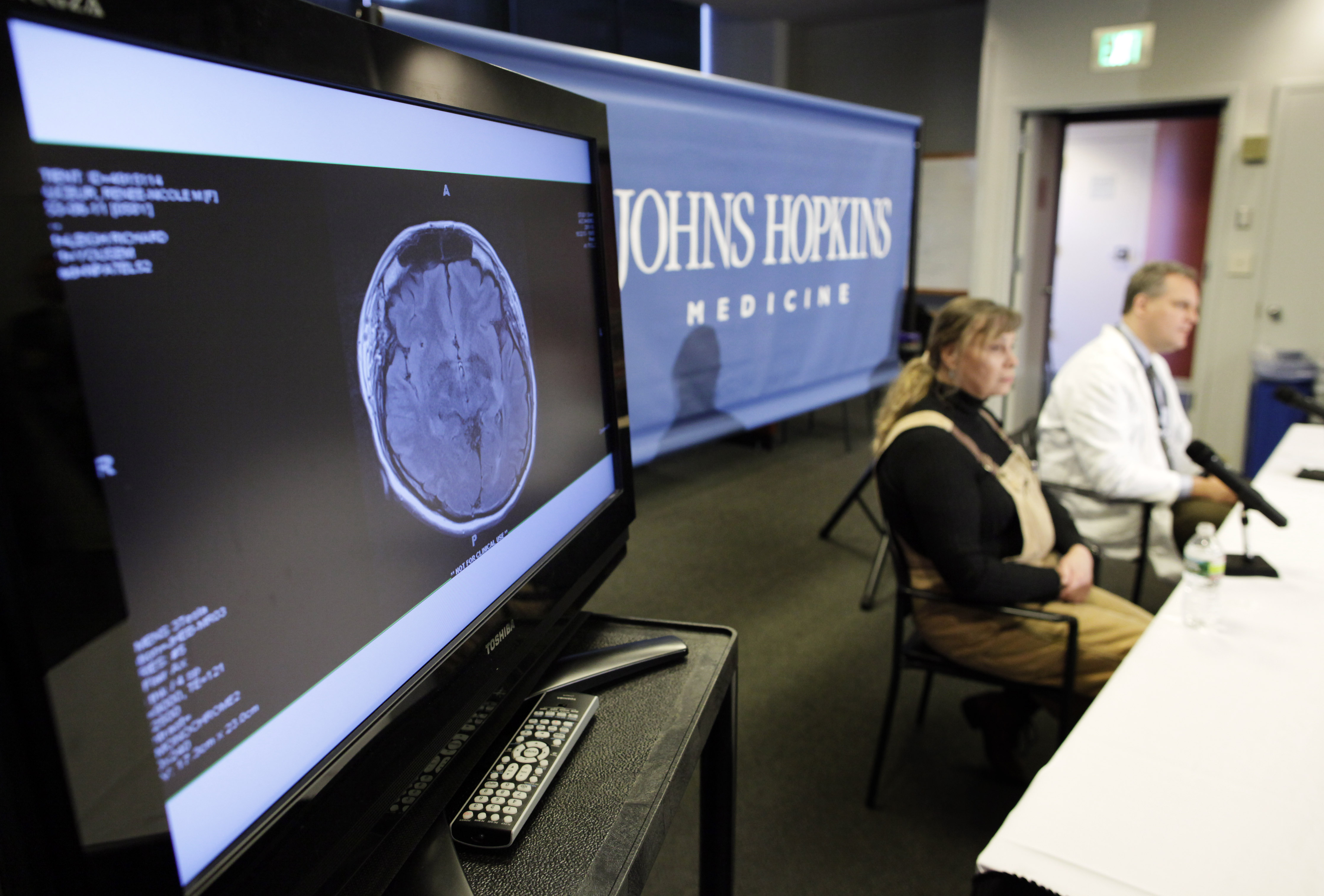 En scan på en hjärna som drabbats av stroke. 