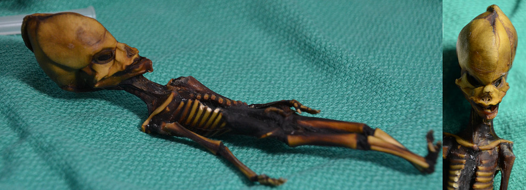 Skelettet Ata Skelettet Ata
