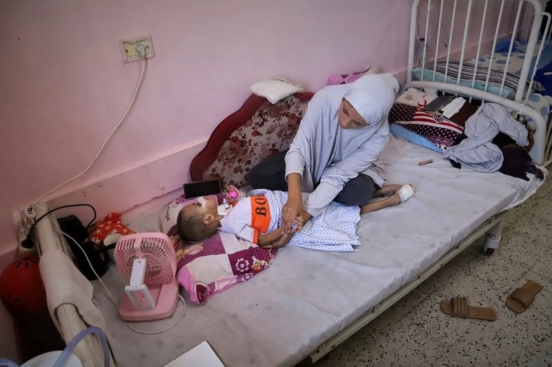 Nour al-Hams, släkting till Amr al-Hams, tror att han i sin flackande blick letar efter mamma. Hon dog i attacken där Amr skadades. Bilden är från den 25 juni.