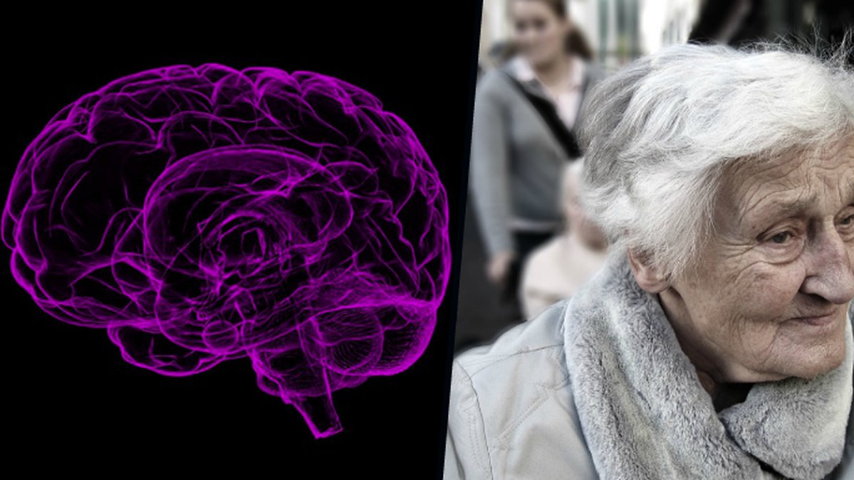 Forskare är nära ett vaccin mot Alzheimers.