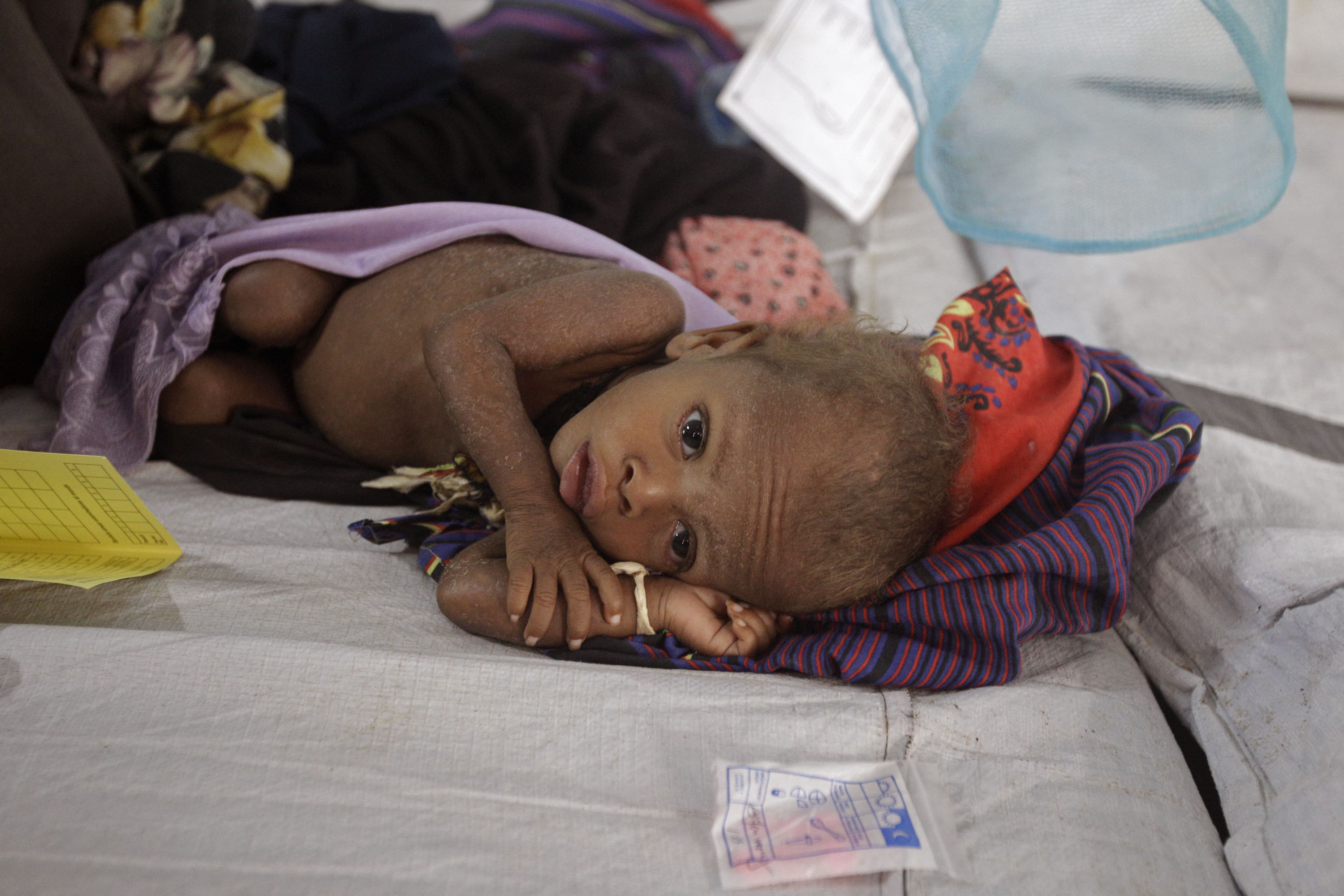 Död, Svält, Kenya, Somalia