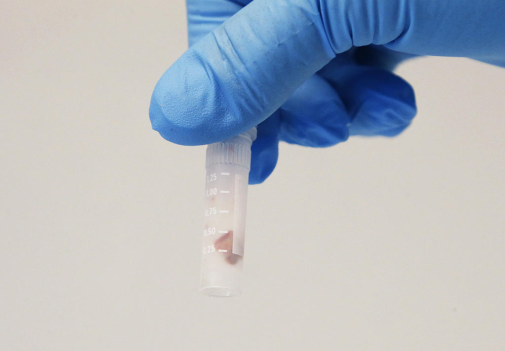 Blodprov för att testa cancer Blodprov för att testa cancer