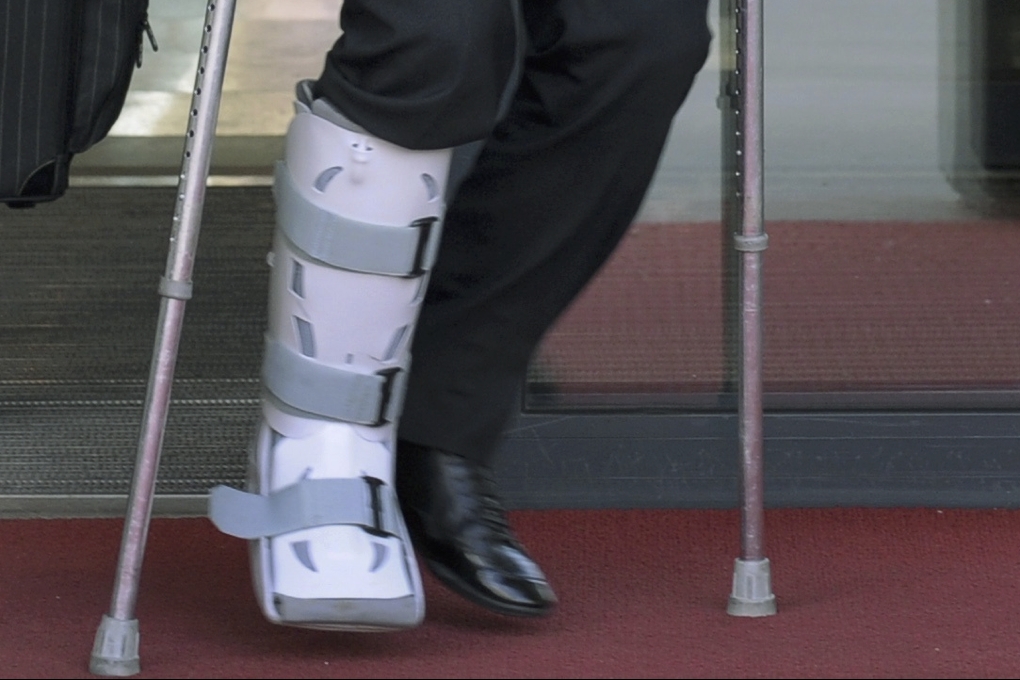 Manchester United-spelaren har fått gå runt med en skyddade sko.