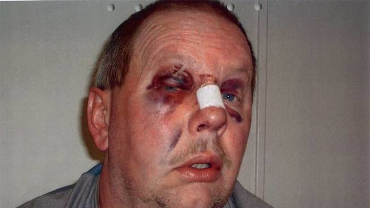 Anders Eklund slogs blodig med gummiklubba.