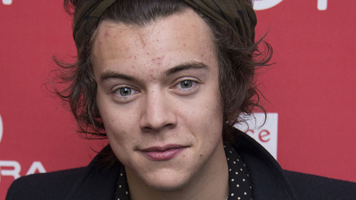 Harry Styles har länge haft problem med acne. 