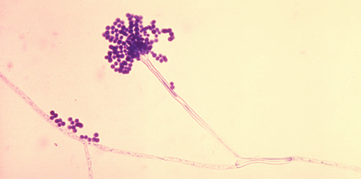 Aspergillus fumigatus Aspergillus fumigatus