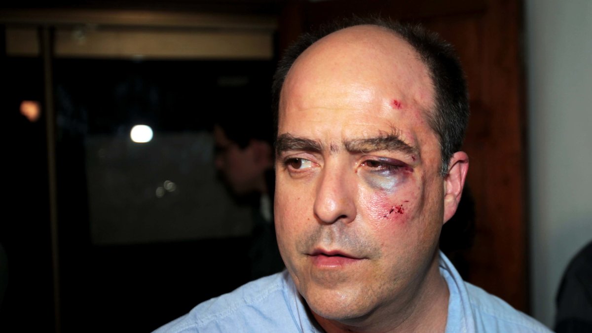 Oppositionspolitikern Julio Borges skador efter slagsmålet.