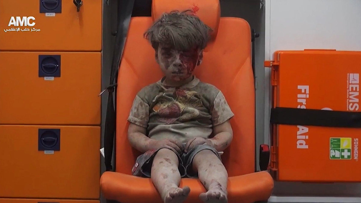 Bilden på den lille pojken Omran syntes överallt från krigsdrabbade Syrien. Så mår han nu.