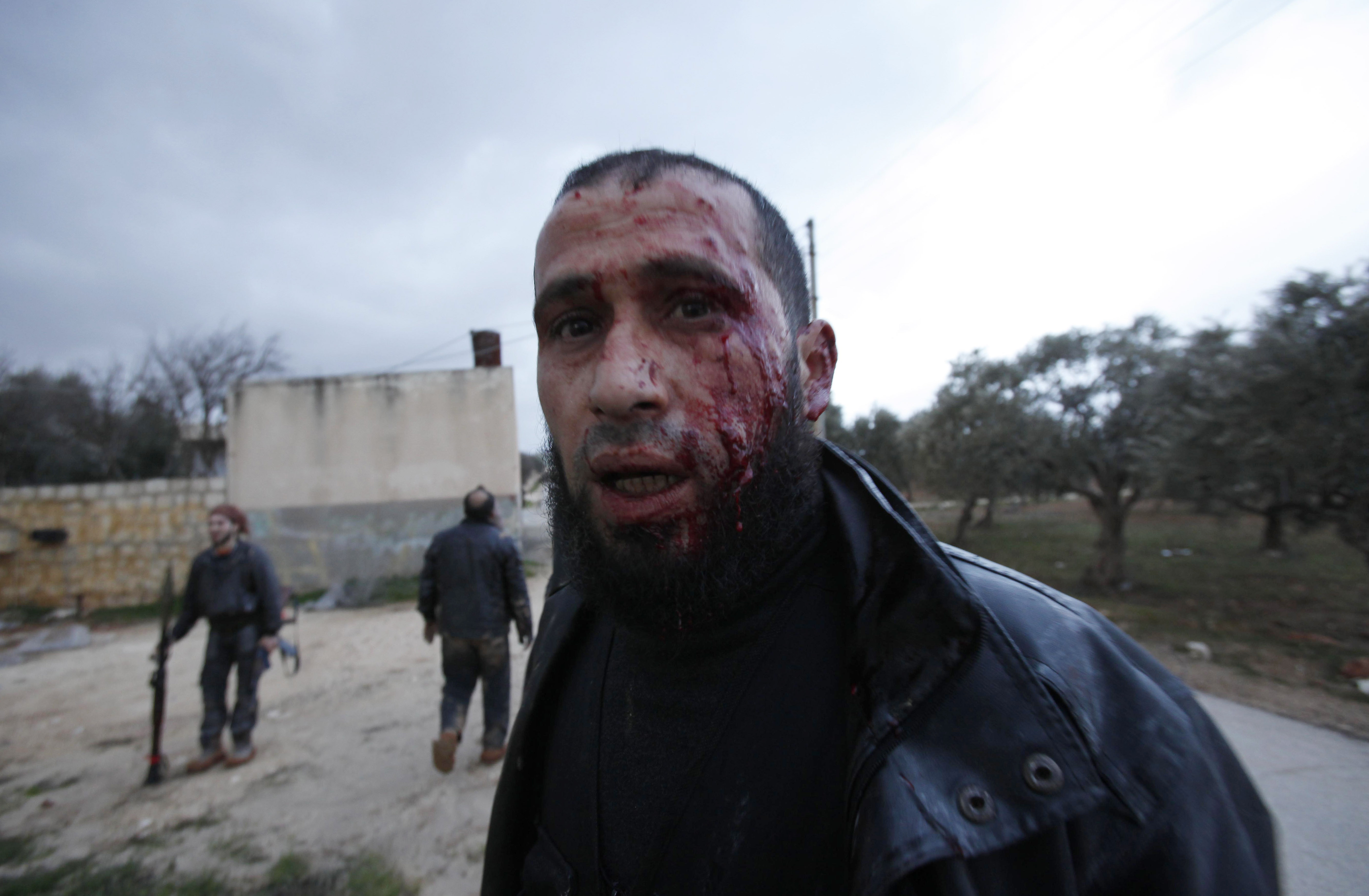 Många har blivit svårt skadade efter sammandrabbningar mellan rebeller och den syriska armén.