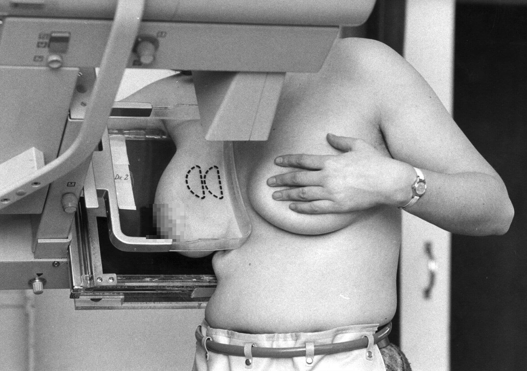 Nu kan kvinnor mellan 40 och 74 år göra en screening för bröstcancer – helt gratis.